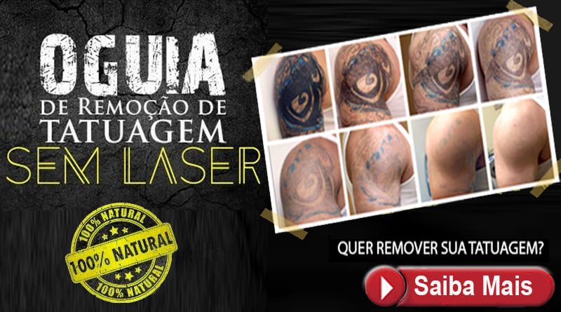 Guia Remoção de Tatuagem